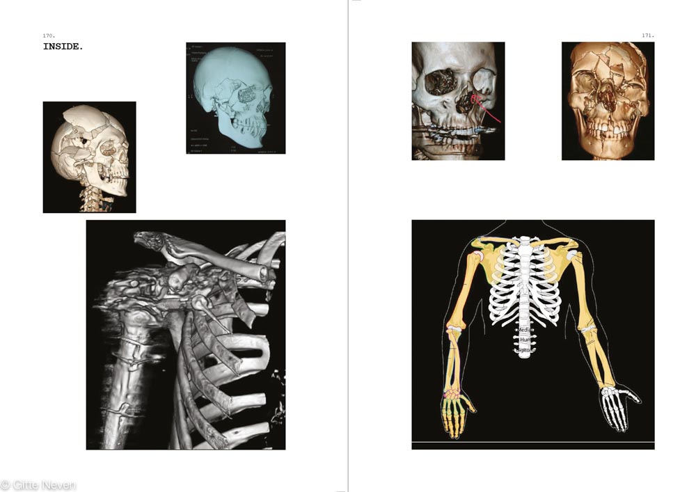 p.170-171 encyclopedia vulgaris